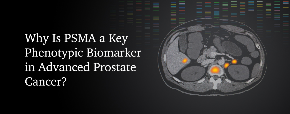 Why is PSMA a key phenotypic biomarker in advanced prostate cancer?